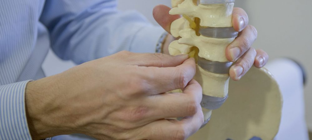 Hernia Discal IMSKE Hernia Discal IMSKE