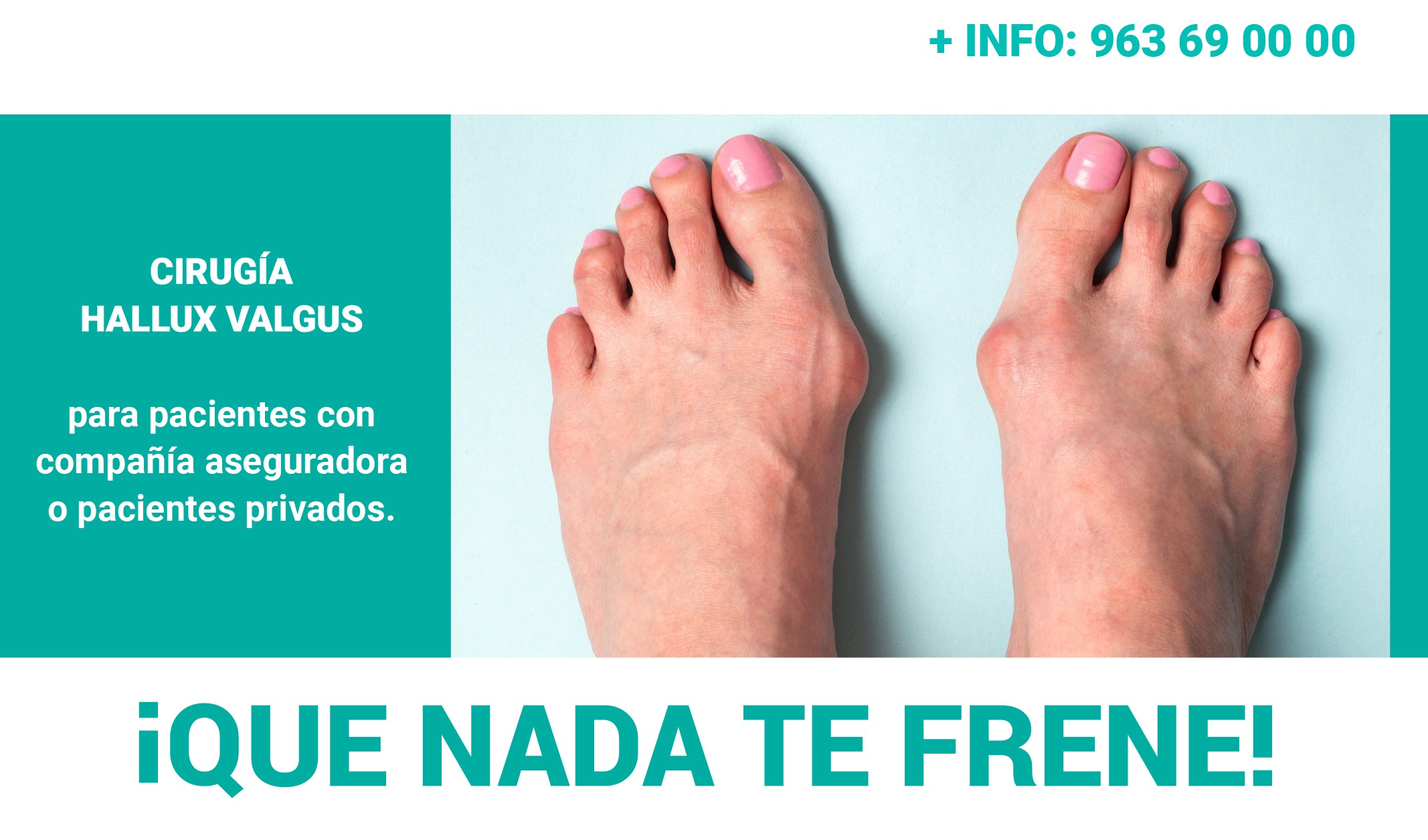 Anuncio Cirugía Hallux Valgus