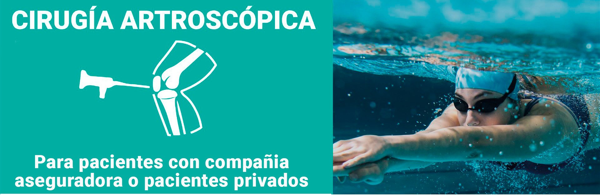 Artroscopia rodlla web La artroscopia de rodilla es un procedimiento quirúrgico que se realiza mediante un instrumento llamado artroscopio. Este instrumento es un tubo delgado con una cámara en su extremo que se introduce en la rodilla a través de una pequeña incisión. La artroscopia de rodilla se utiliza para diagnosticar y tratar una variedad de problemas de la rodilla, como lesiones de ligamentos, cartílago dañado y desgaste de la superficie de la articulación.