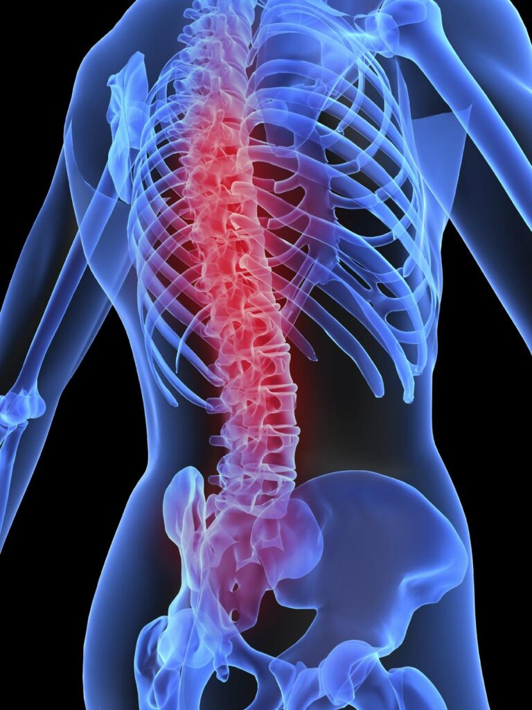 Imagen de dolores de espalda, dolores funcionales Hospital Ribera IMSKE es un hospital de traumatología y rehabilitación situado en Valencia. Es una institución médica líder en la prevención, el diagnóstico y el tratamiento de enfermedades musculoesqueléticas. Avalado por un equipo multidisciplinar de más de 100 profesionales altamente cualificados y especializados, Ribera IMSKE consolida su posición como centro de excelencia en el sector de la medicina y ofrece al paciente la cobertura de todas las especialidades musculoesqueléticas. La traumatología y la rehabilitación eso nuestras pasiones, y el compromiso y el cuidado sin límites con el paciente, nuestra prioridad.
