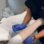 linfedema en Ribera IMSKE